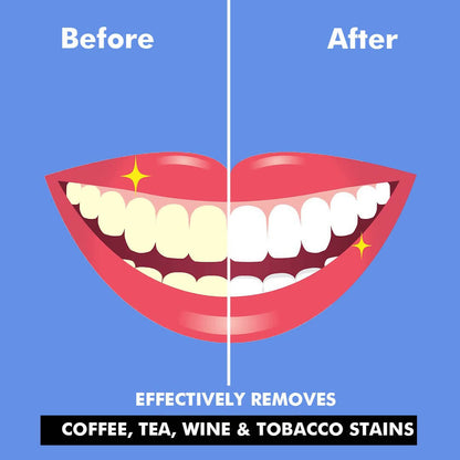 Perfora Teeth Whitening Powder