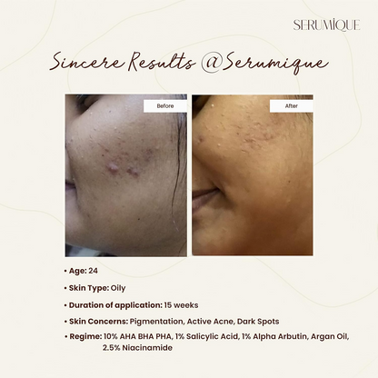 Serumique 23% AHA + 2% BHA + 5% PHA Wash-Off Serum Exfoliator - New You 30%