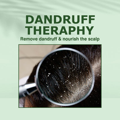Nuerma Science Anti-Dandruff Hair Oil | Dandruff Relief & Scalp Rejuvenation