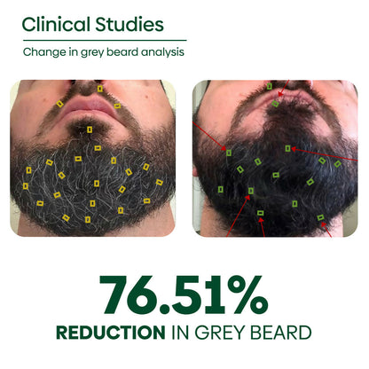 Rishi Natural Anti-Grey Beard Serum Oil