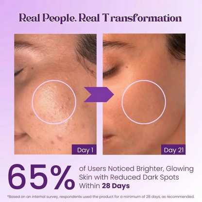 Pokonut Kumkumadi Tailam Face Oil