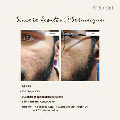 Serumique Salicylic Acid Face Serum No More Pores Starter Conc. 1%