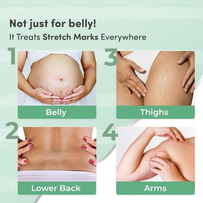 Mylo Care Stretch Marks Combo