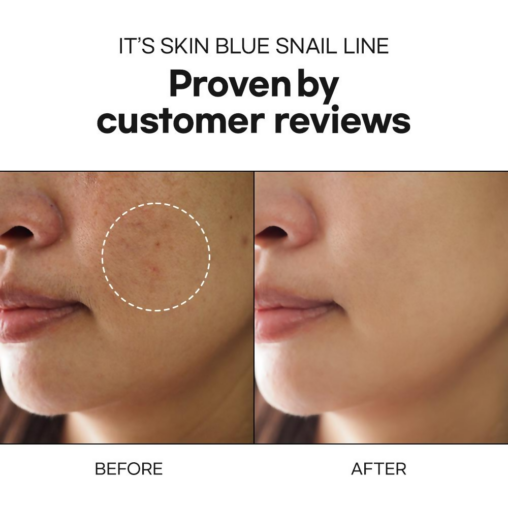 It's Skin Blue Snail Serum
