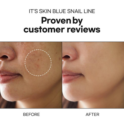 It's Skin Blue Snail Serum