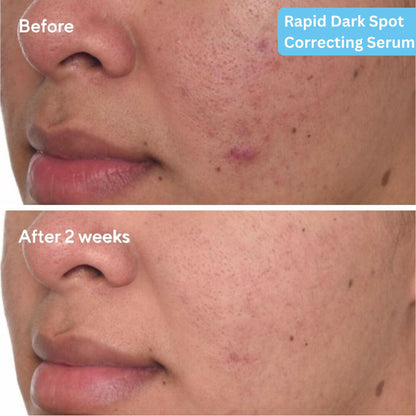 SkinLuv Dark Spot Correcting Serum