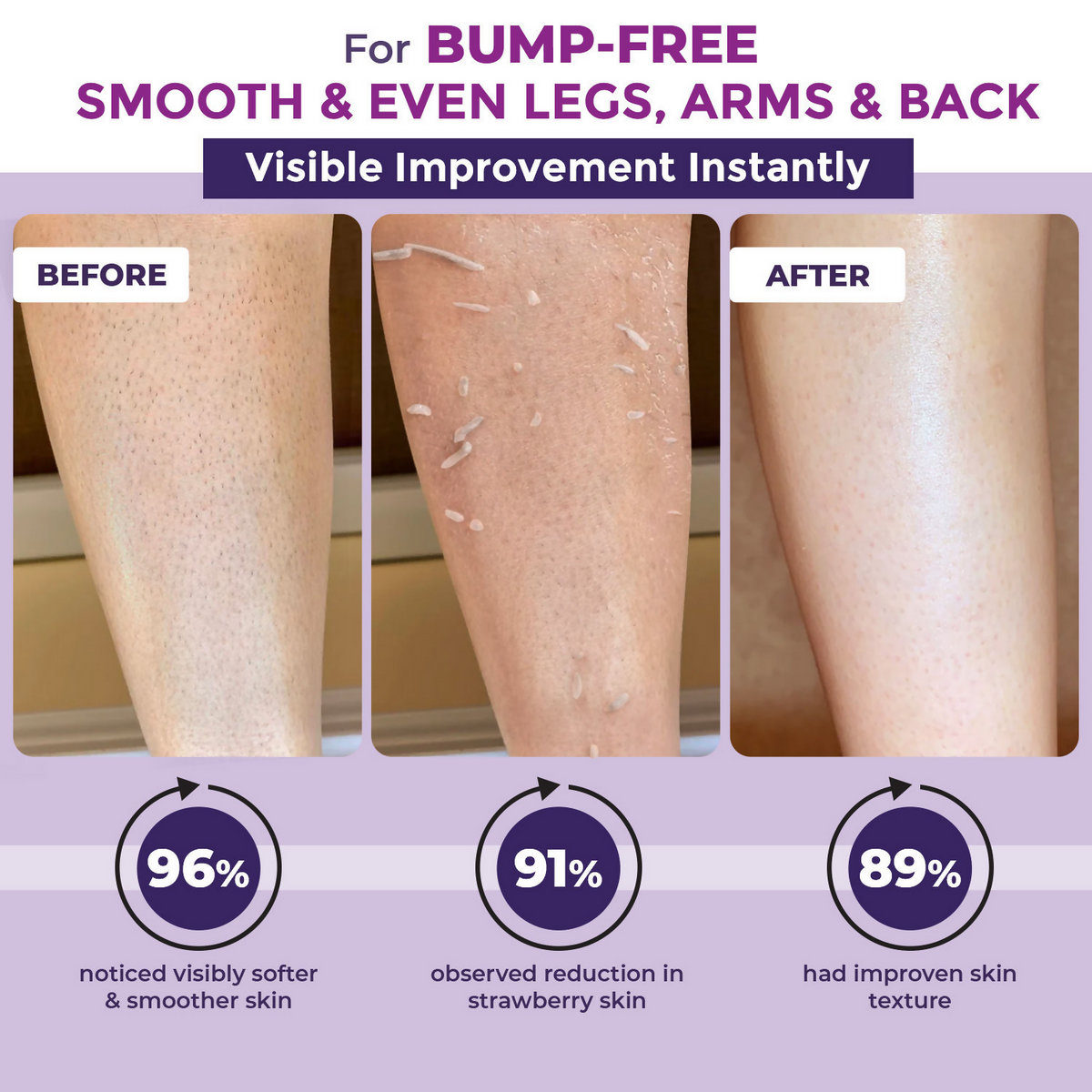 Sanfe Instant Bumps Eraser Exfoliating Gel