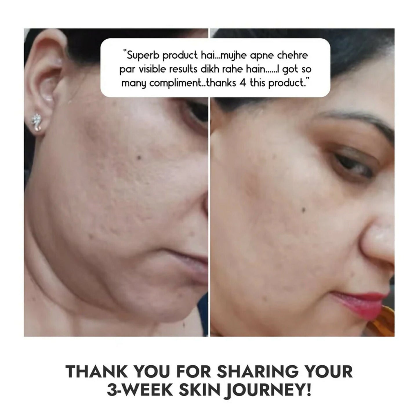 Cos-IQ Niacinamide Vitamin B3-10% Face Serum for Ultra Sensitive Skin