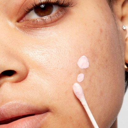 Mario Badescu Acne Spot Corrector Drying Lotion with Salicylic Acid