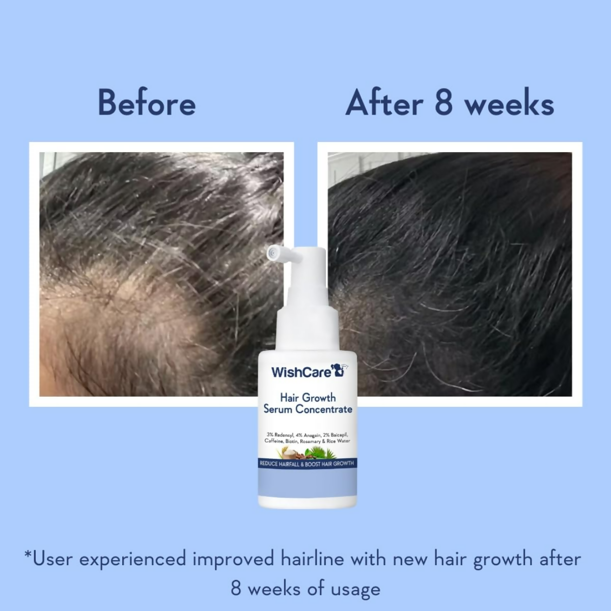 WishCare Hair Growth& Anti Hairfall Range with Serum, Shampoo & Conditioner Combo
