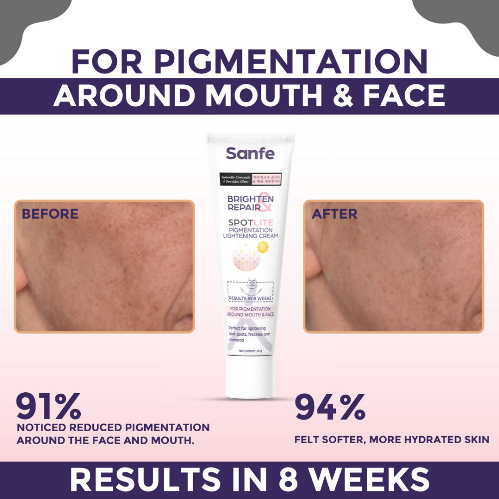 Sanfe Brighten & Repair Spotlite Pigmentation Lightening Cream