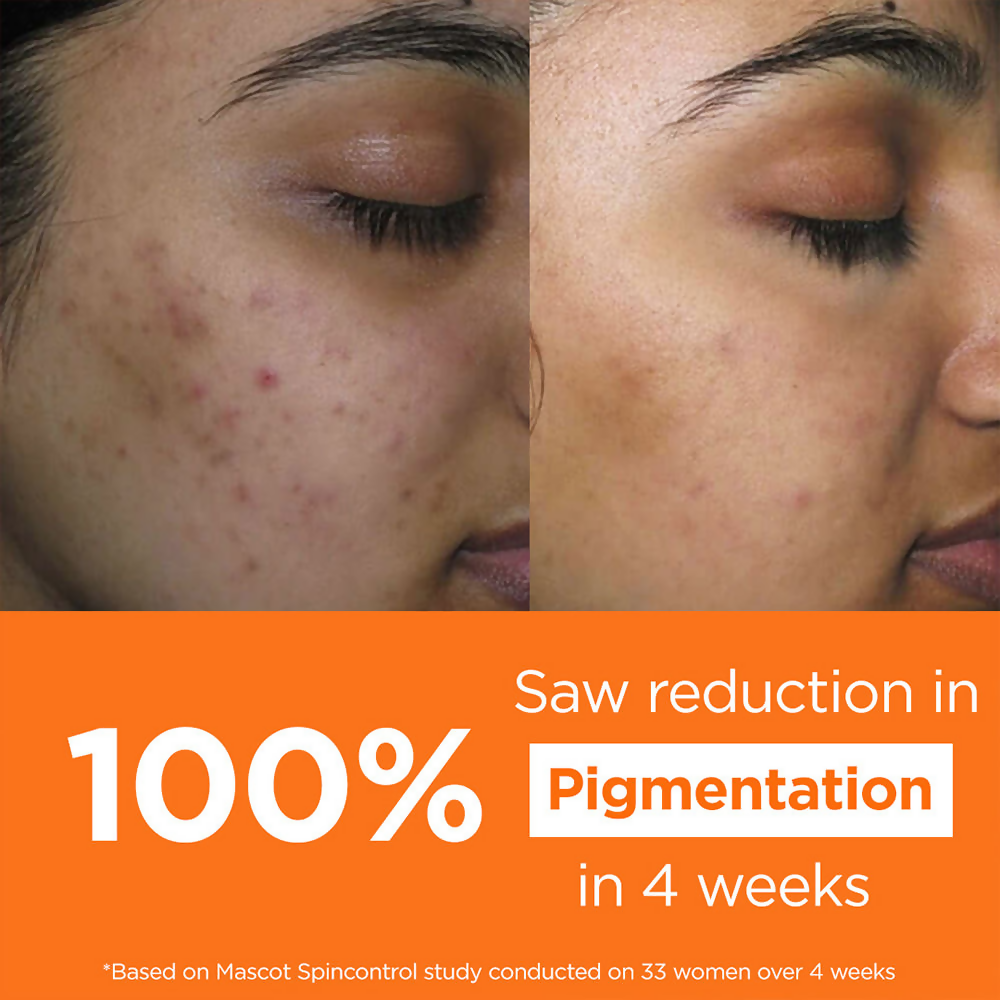 Light Up Vitamin C Face Cream For Pigmentation Ageing And Collagen