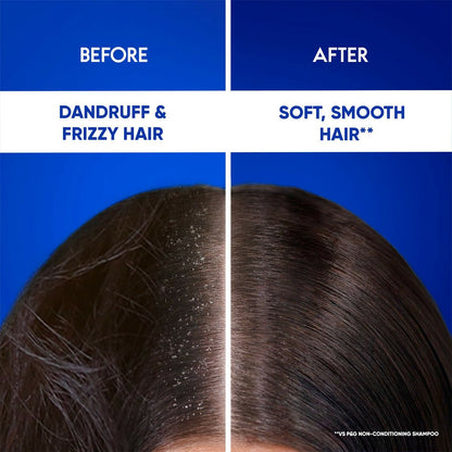Head & Shoulders 2-in-1 Smooth and Silky Anti Dandruff Shampoo + Conditioner
