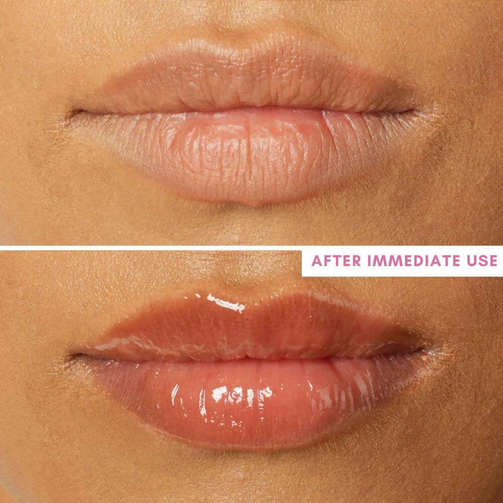 The Skin Diet Company Lip Barrier Oil Clear Gloss with Peptides Hydrates, For Dry & Pigmented Lips