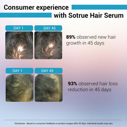 Sotrue Hair Growth Serum With Redensyl 3%, Procapil 3%, Anagain 4% and Baicapil 2% Hair Growth Actives