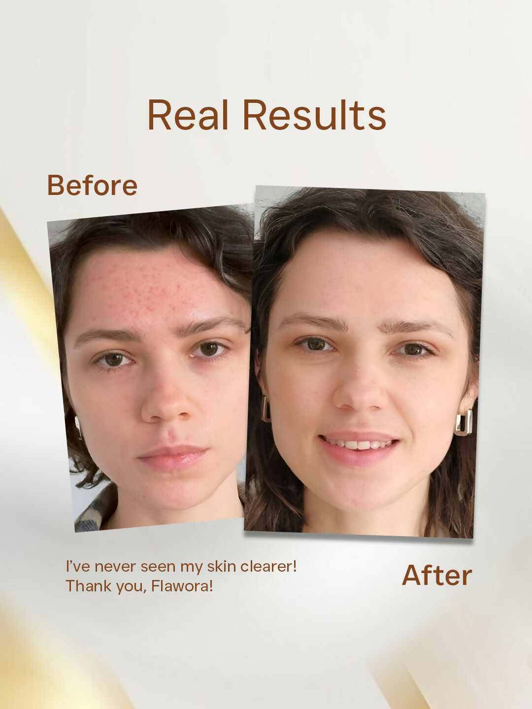 Flawora Anti Acne Serum