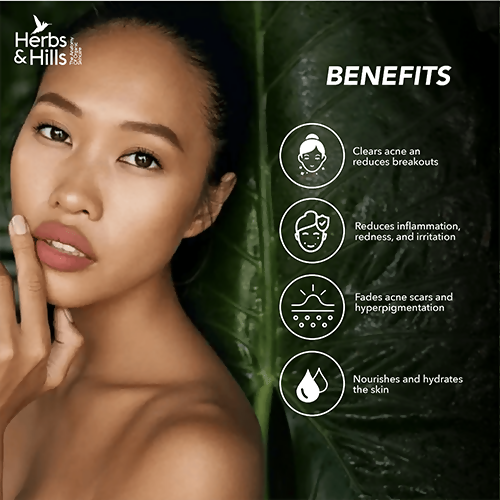 Herbs & Hills Anti Acne Face Pack