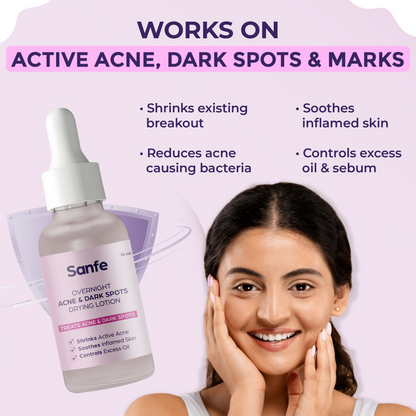 Sanfe Overnight Acne & Dark Spots Drying Lotion