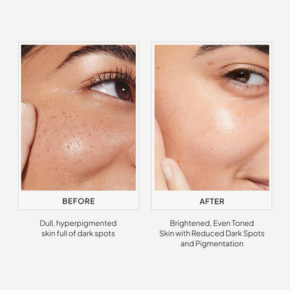 Miduty by Palak Notes EpiLight Night Serum