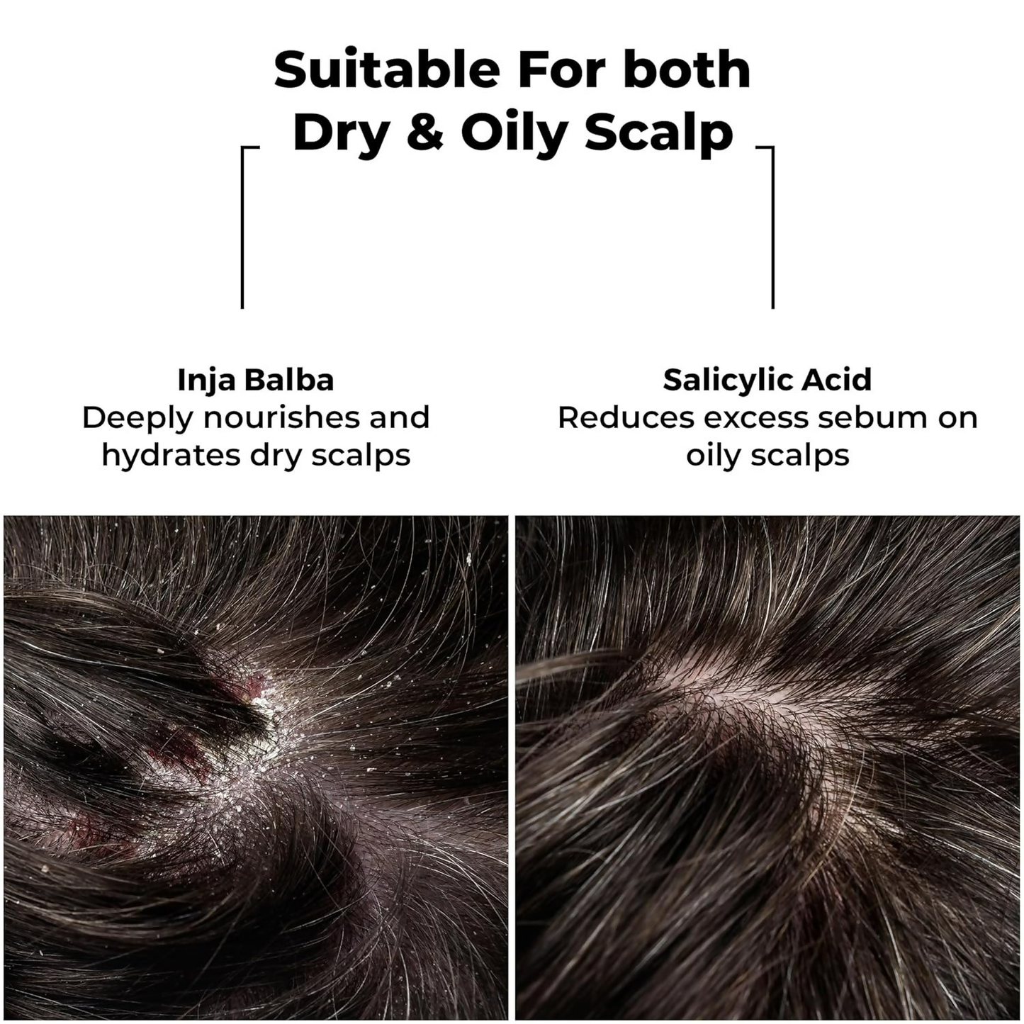 Brillare Dandruff Control Shampoo