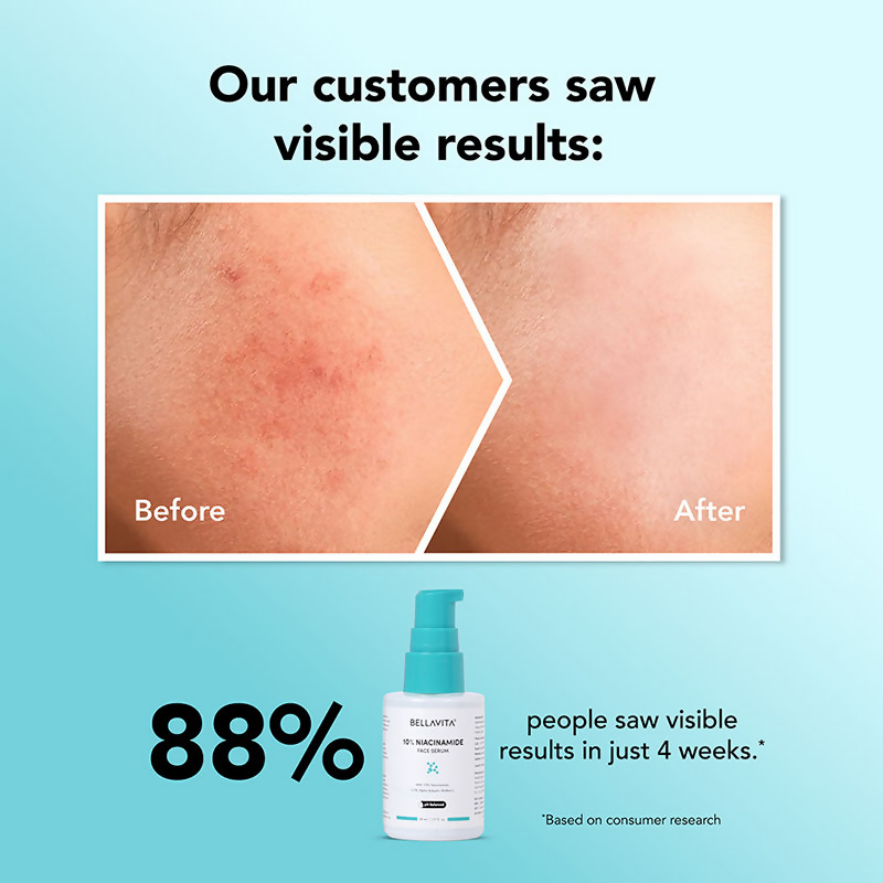 Bella Vita Organic Niacinamide Face Serum