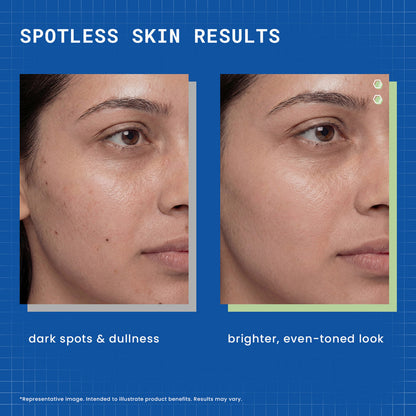 Dermdoc 2% Kojic Acid Face Serum