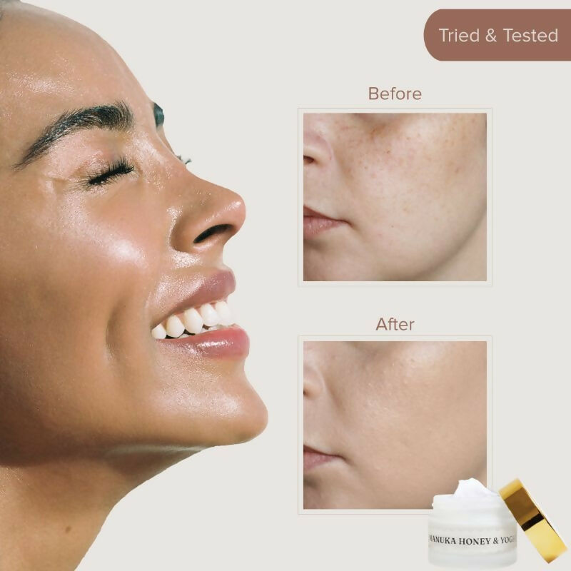 Dromen & Co Manuka Honey & Yoghurt Serum Moisturiser - Hydrates & Deep Nourishes, Reduces Wrinkles