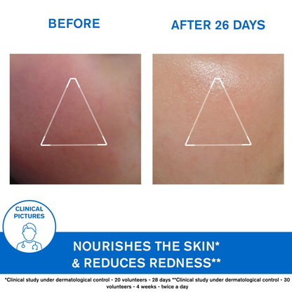 Uriage Xemose Face Cream