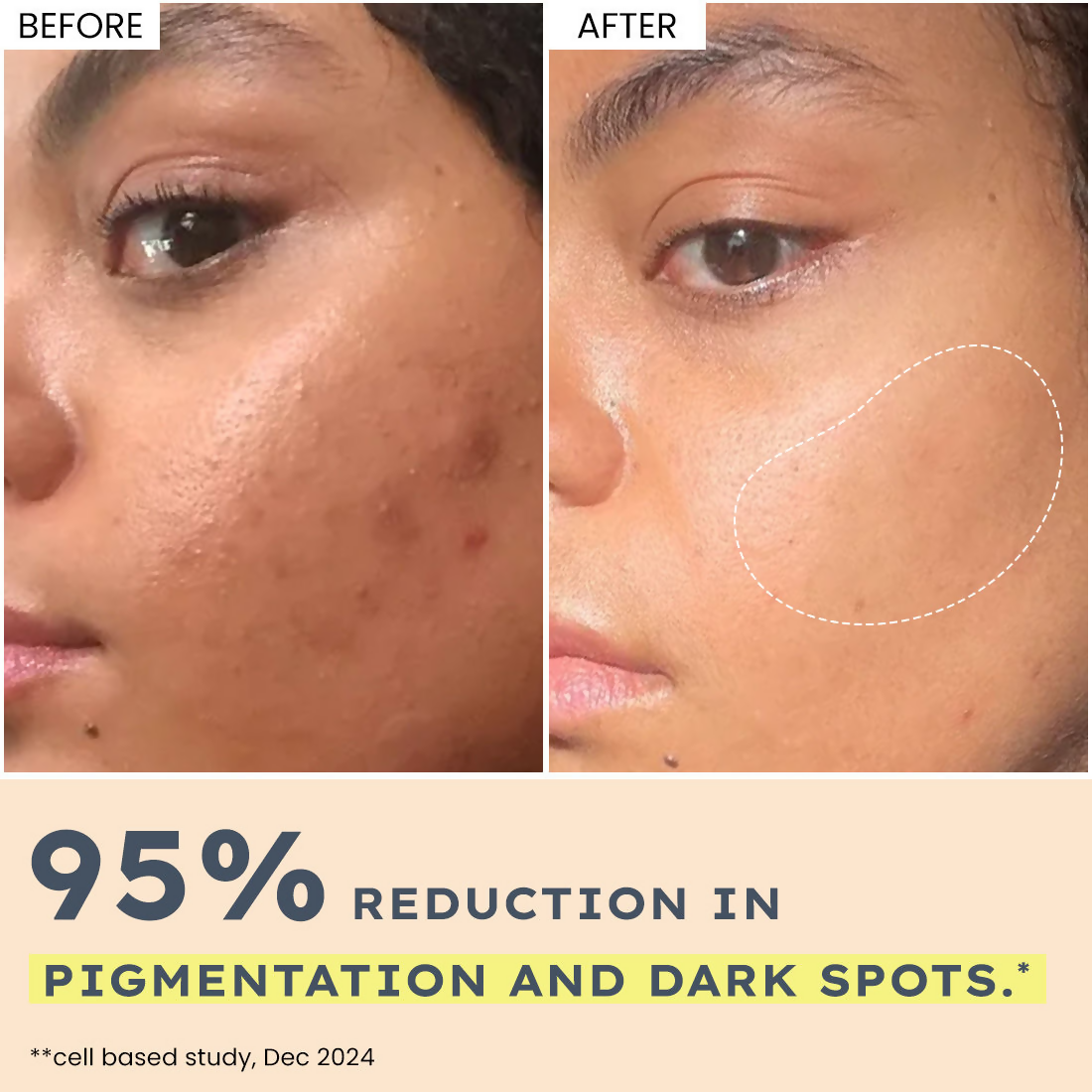Hyphen By Kriti Sanon 44% Rice Water Brightening Serum Pads (50pcs)