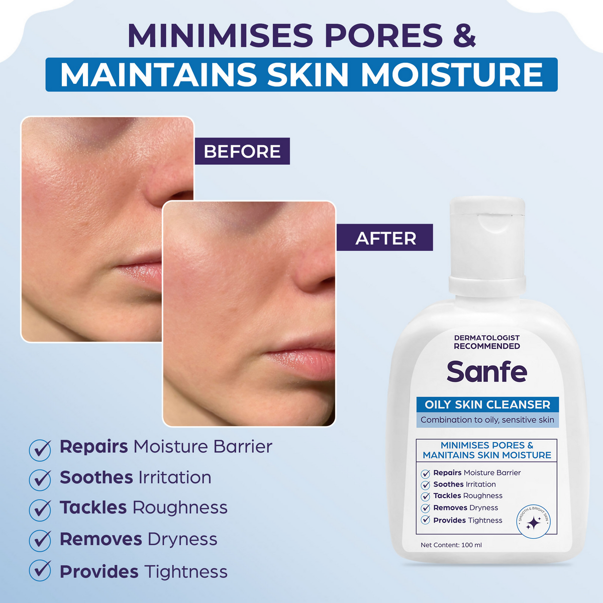Sanfe Oily Skin Cleanser Minimises Pores & Maintains Skin Moisture cetaphil skin repair Face Wash