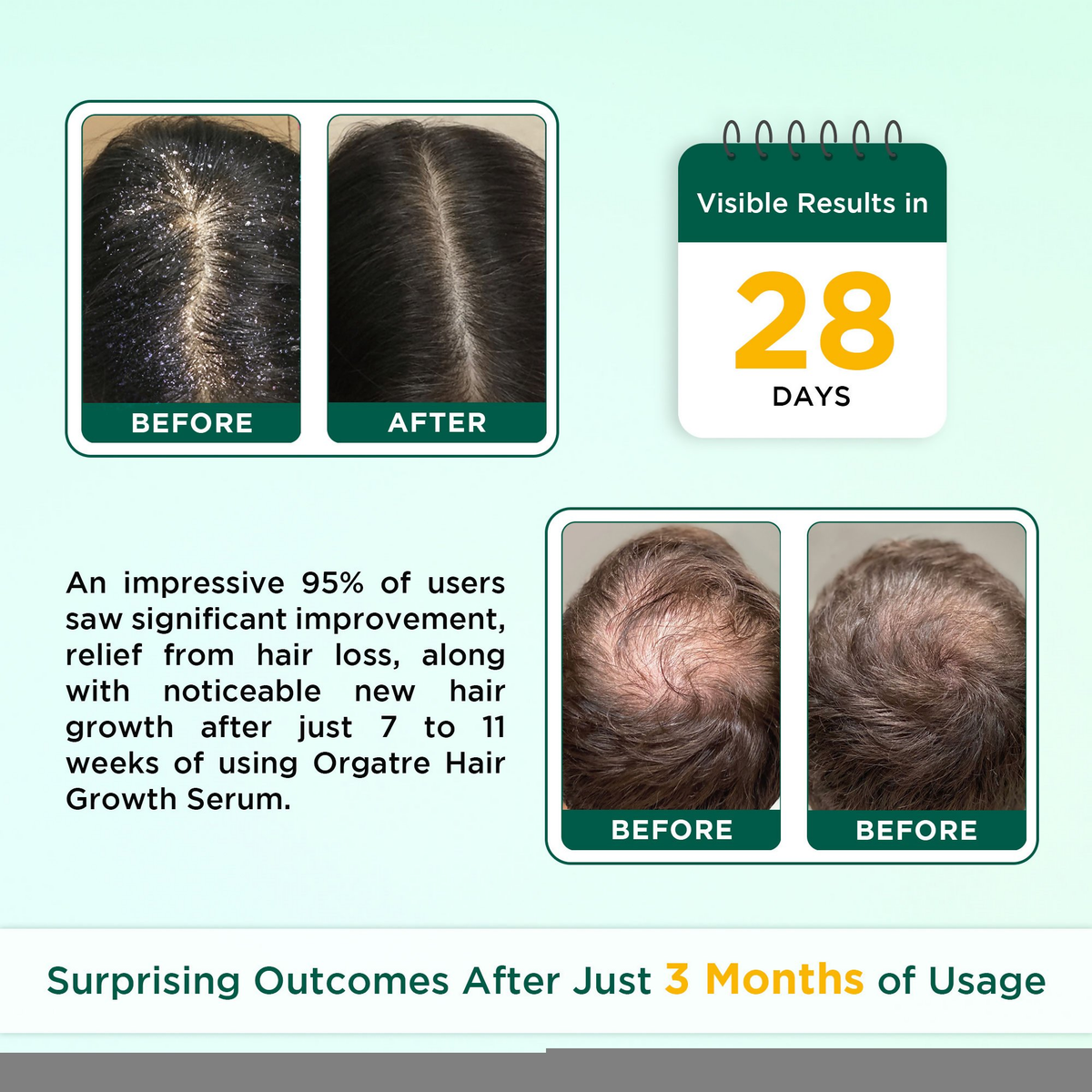 Orgatre Hair Growth Oil With 28 Herbal Oils ??Promotes Hair Growth, Reduces Hair Fall & Dandruff