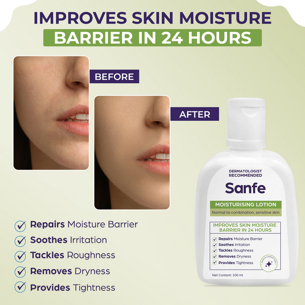 Sanfe Moisturising Lotion Improves skin moisture in 24 hour Moisturizer