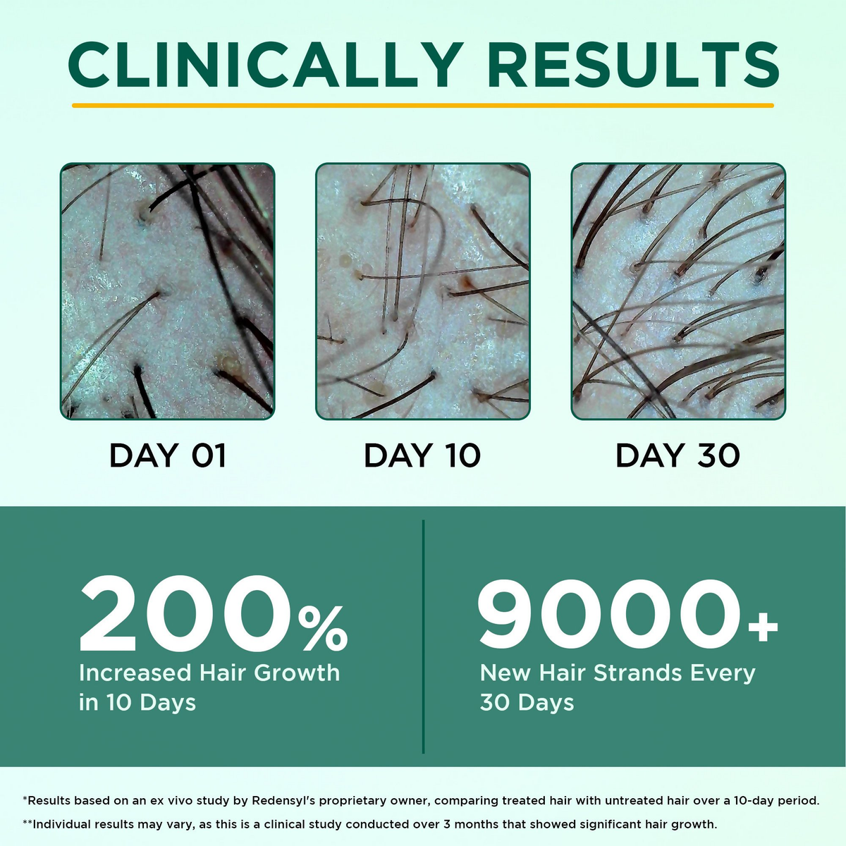 Orgatre Hair Growth Oil With 28 Herbal Oils ??Promotes Hair Growth, Reduces Hair Fall & Dandruff