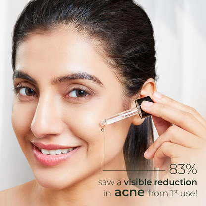 Xyst 10% Niacinamide Anti Acne Serum Face Serum