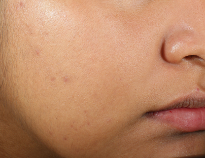 Murad Clarifying Water Gel