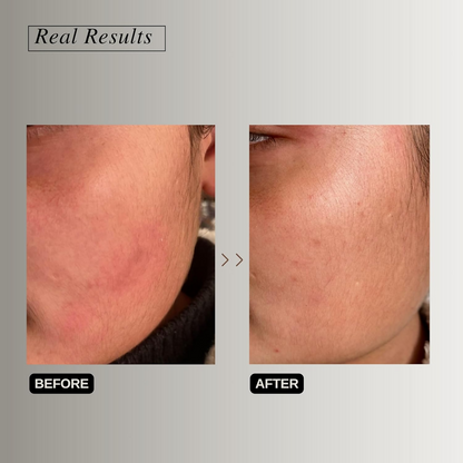 The Formularx Peptide Ceramide Moisturizer - Barrier Plus