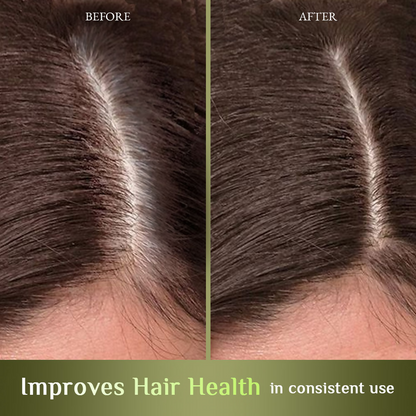 Richfeel Hair Nourisher Oil - Hair Fall Control & Growth Treatment