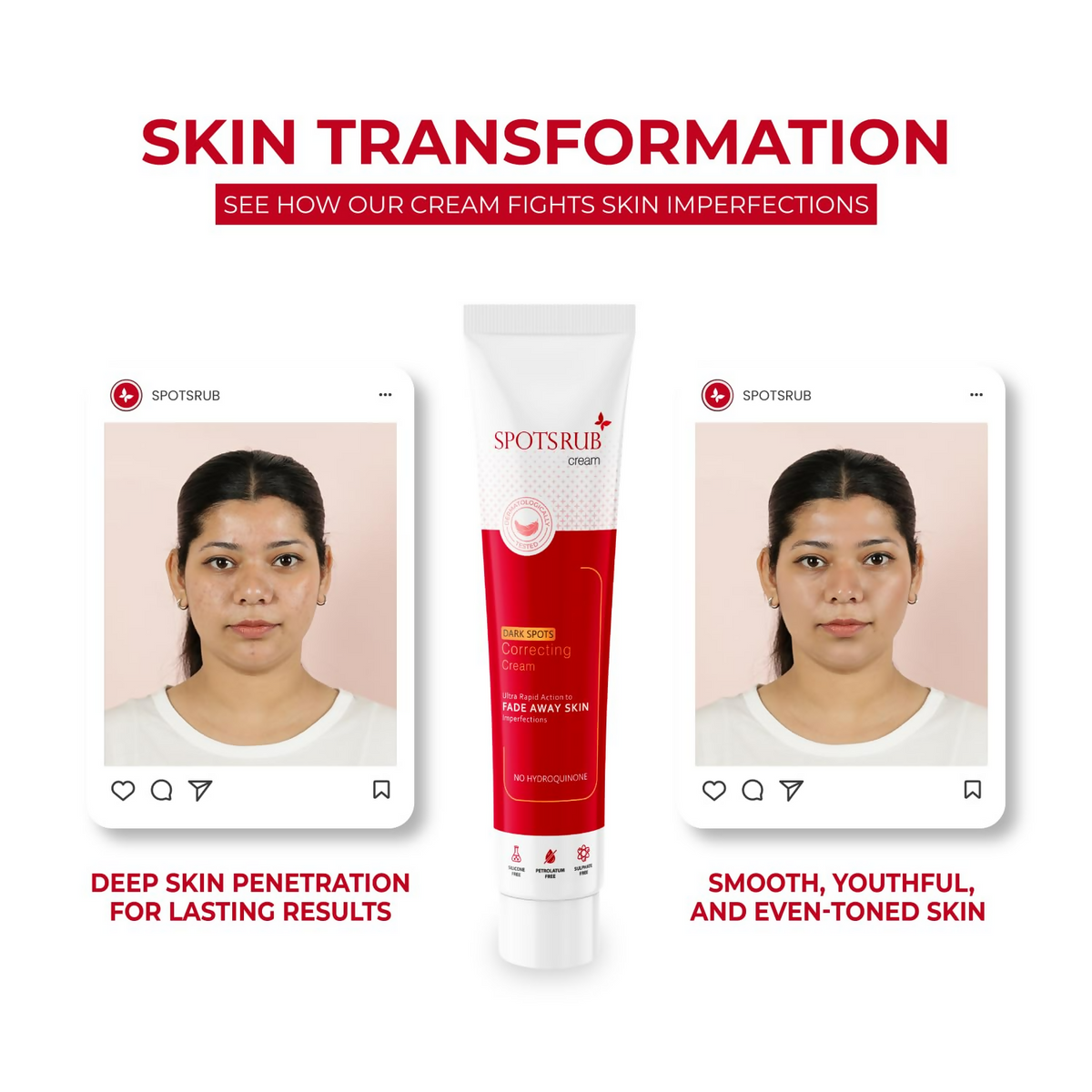 Leeford Spotsrub Face Cream For Women